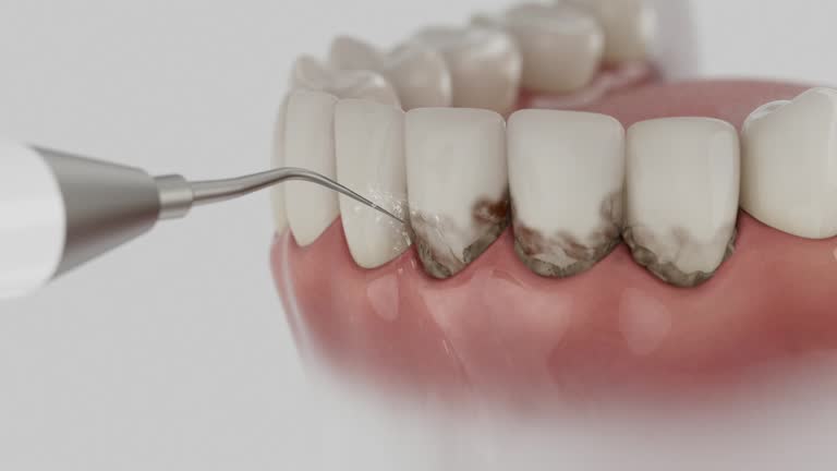 Trusted Emergency Dentist service in Ashville, AL - Dentist Open Now